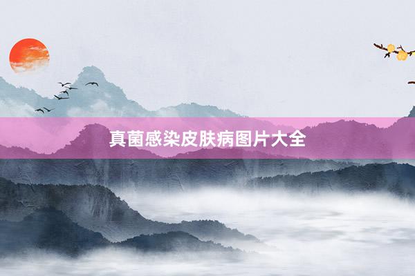真菌感染皮肤病图片大全